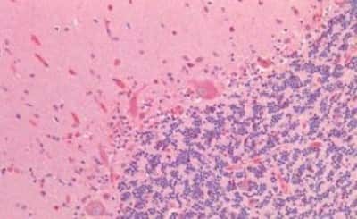 Immunohistochemistry-Paraffin: Neuritin Antibody [NBP3-14419] - Human Brain, Cerebellum: Formalin-Fixed, Paraffin-Embedded (FFPE)
